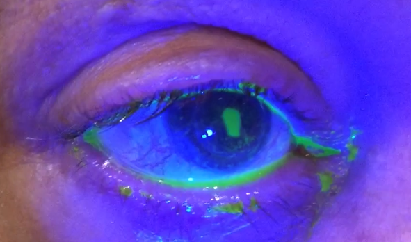 Product image for Corneal Foreign Bodies and Minor Trauma
