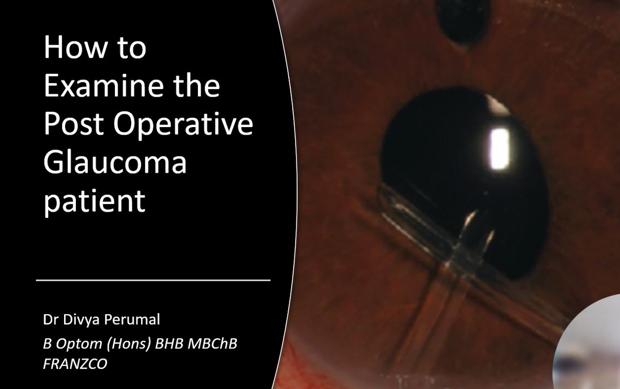 Product image for How to Examine the Post-operative Glaucoma Patient
