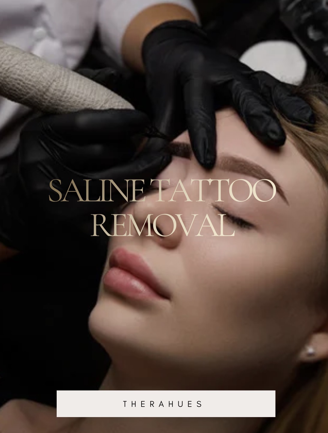 Product image for Emergency Tattoo Removal
