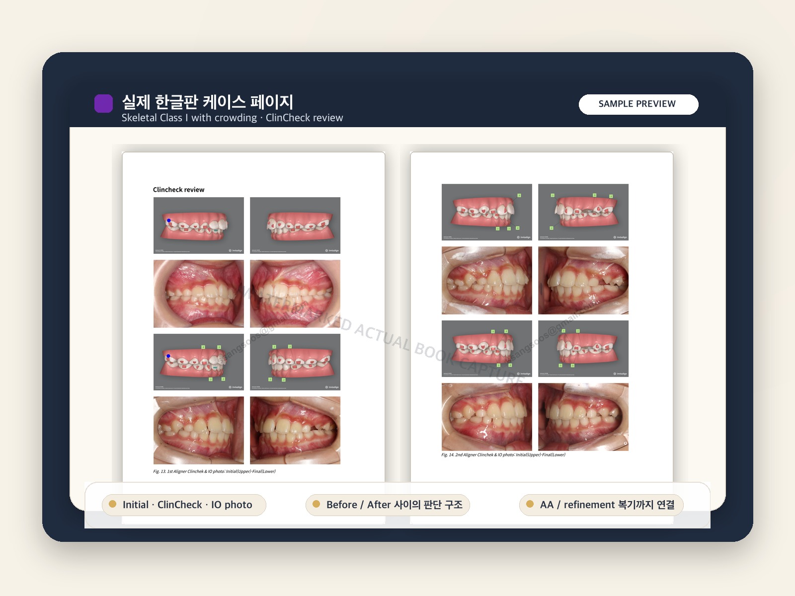 IMAGE SLOT — 실제 전자책 내지 또는 ClinCheck 대표 페이지