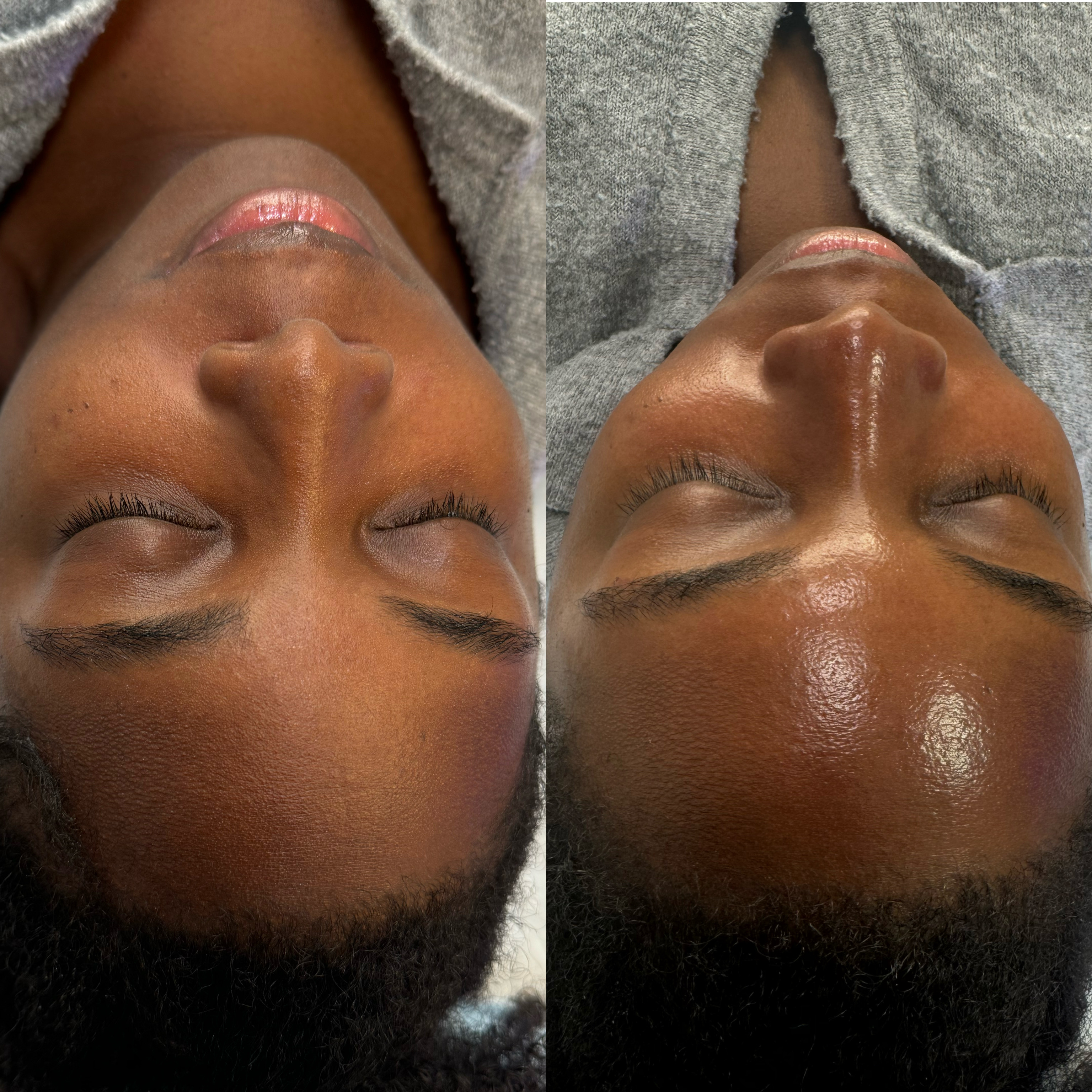 Product image for Dermaplane Advanced technique