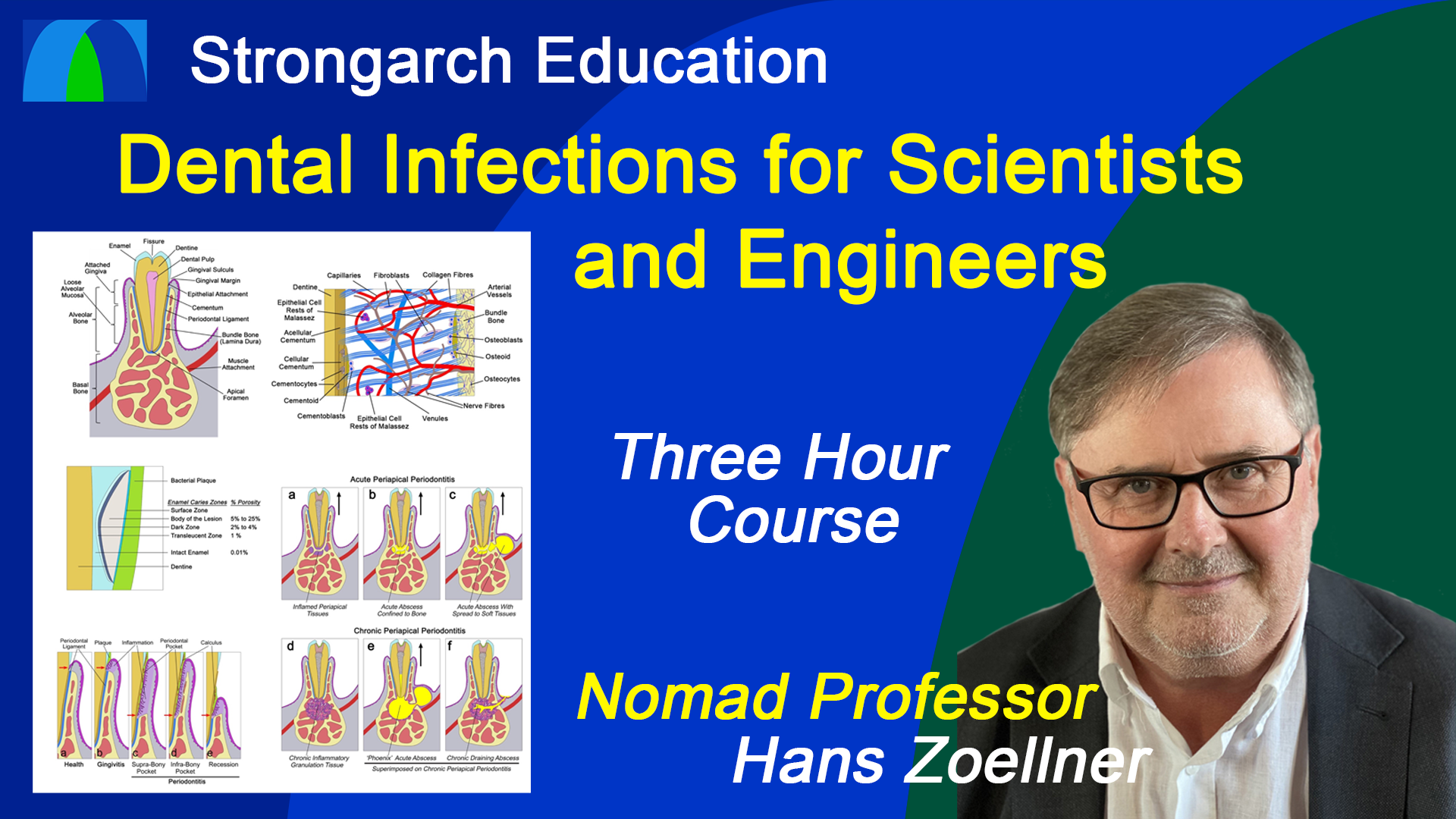 Product image for Dental Infections for Scientists and Engineers