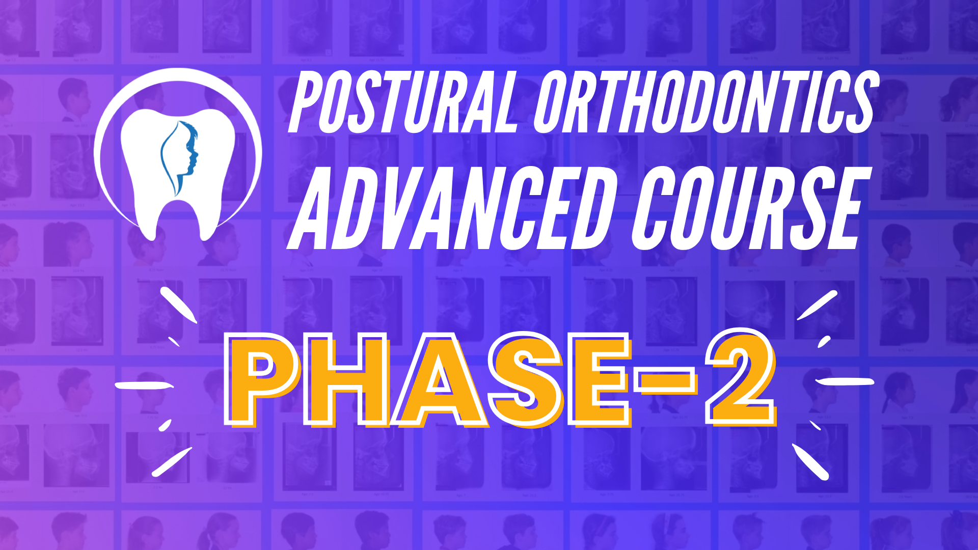 Product image for Postural Orthodontics Advanced Course Phase-2 (Latest)