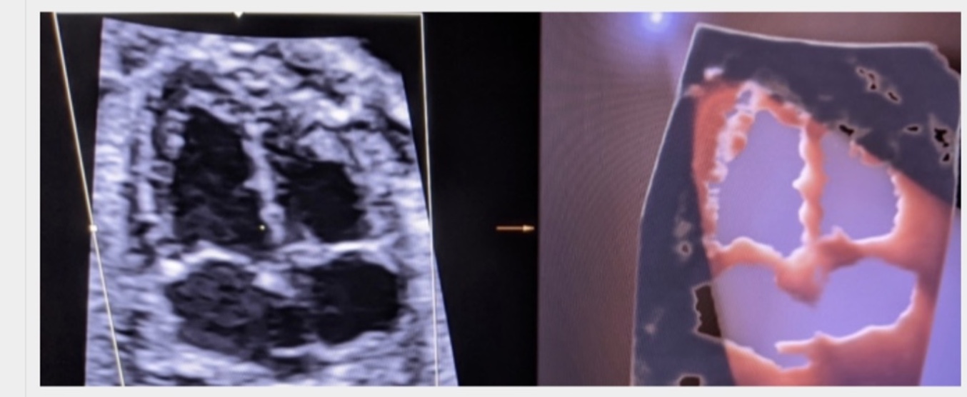 Product image for Introduction to the Fetal Heart: A Sonographer's Perspective