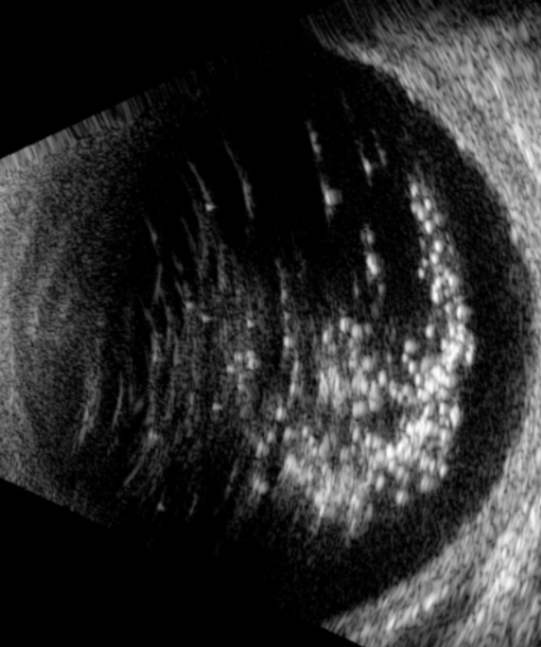 Imagen de producto para MÁSTER-CLASS: ECOGRAFÍA OCULAR