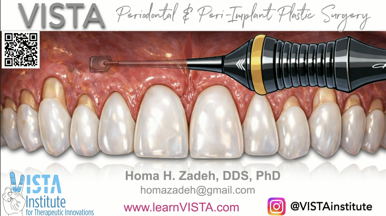 Product image for VISTA For Soft Tissue Augmentation - 2026