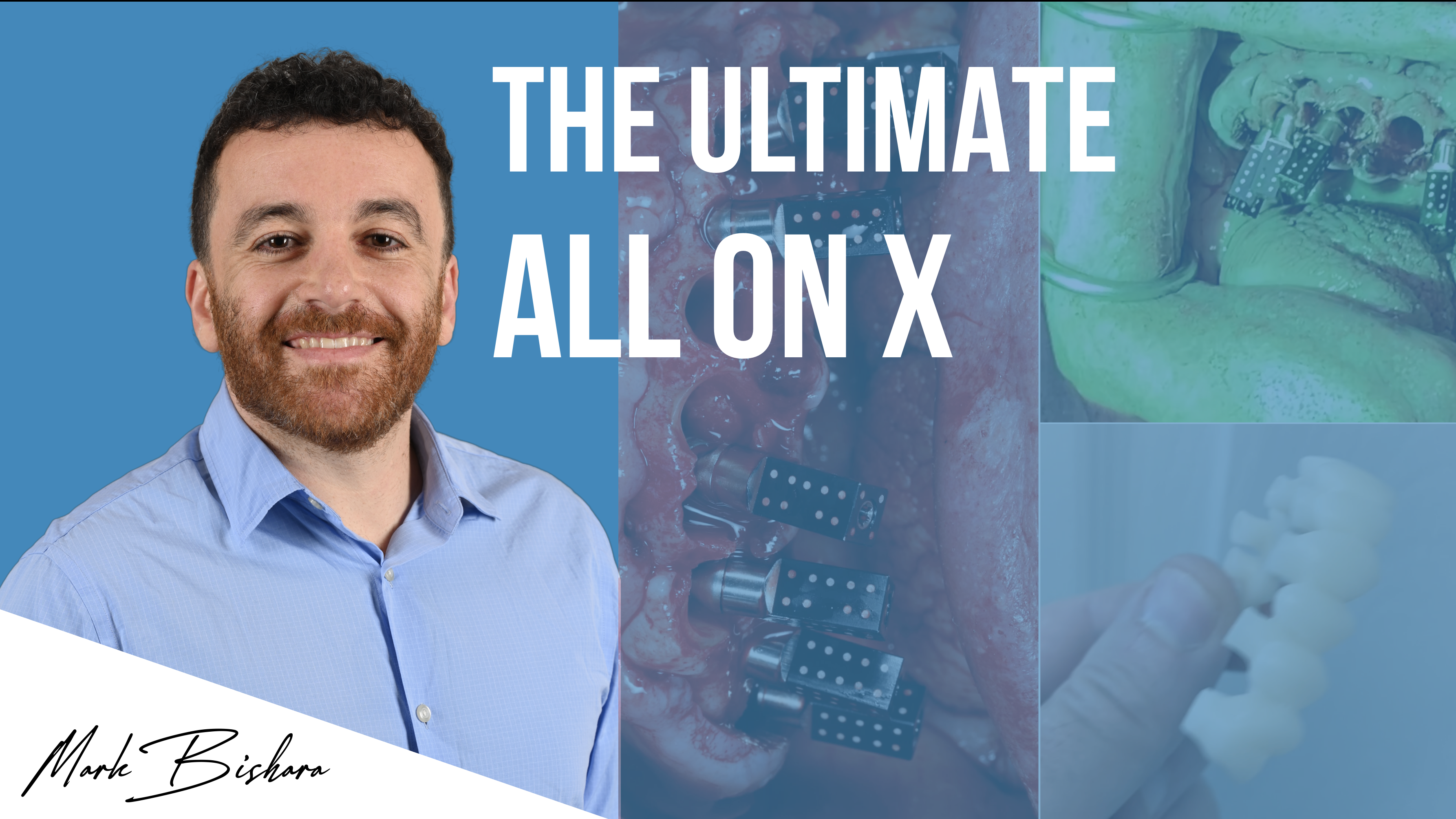 Product image for Ultimate All on X Montreal