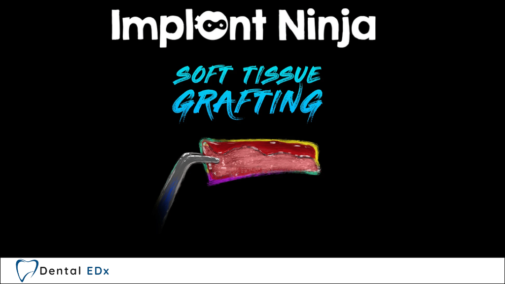 Product image for Ninja Soft Tissue Grafting