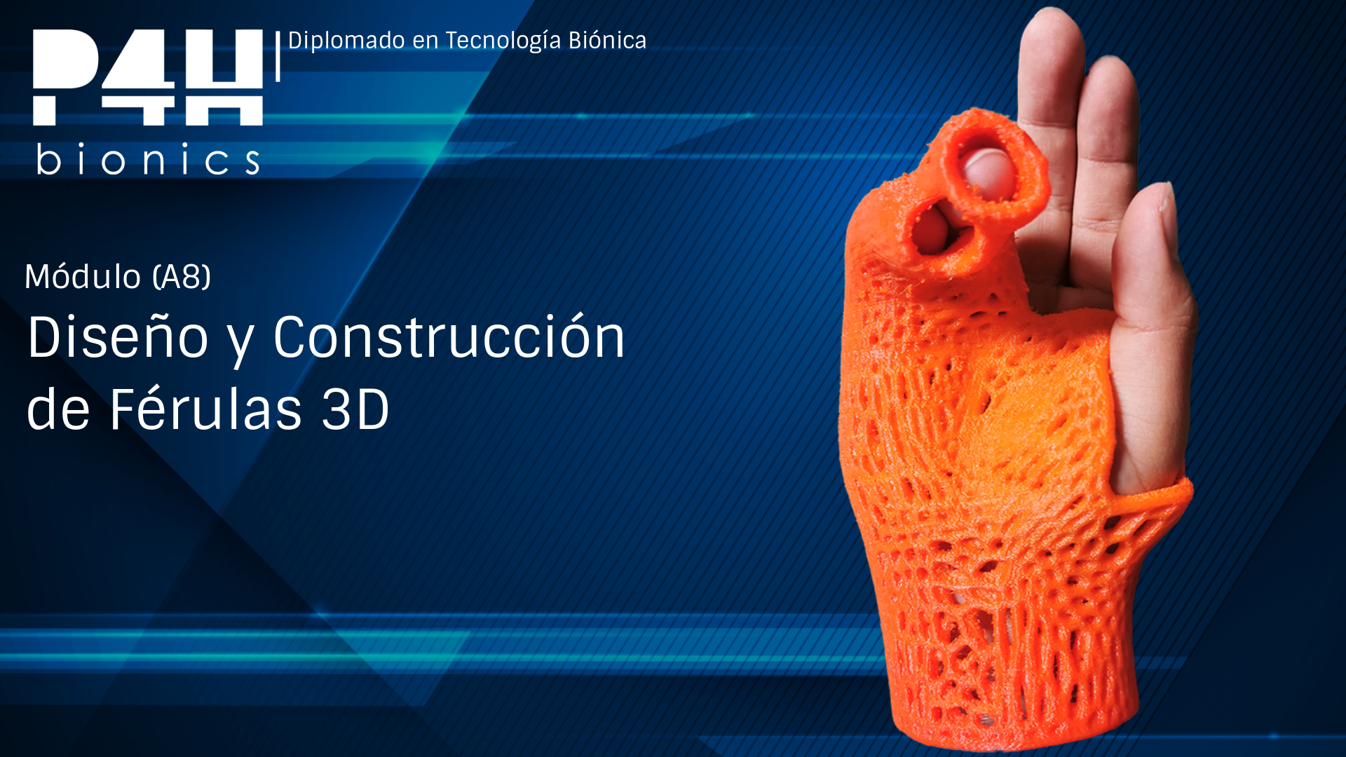 Imagen de producto para (Fase 11.1) Diseño y Producción de Férulas 3D