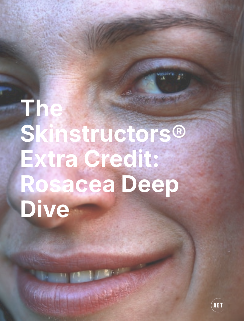 Product image for The Skinstructors® Extra Credit: Rosacea Deep Dive