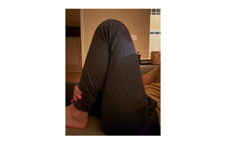 Nawid Rehab Tibial Plateau Fracture