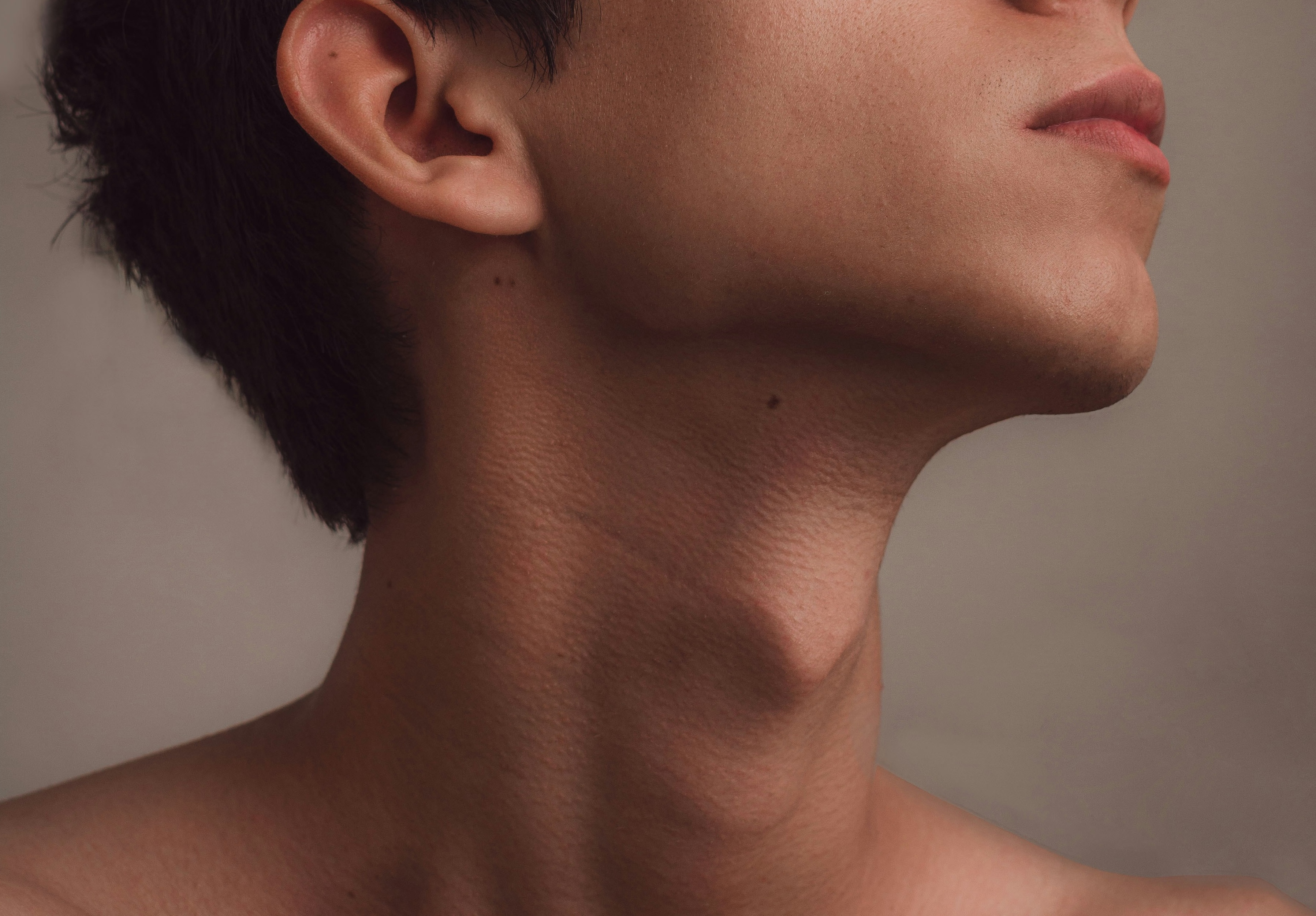 Product image for Neck Liposuction