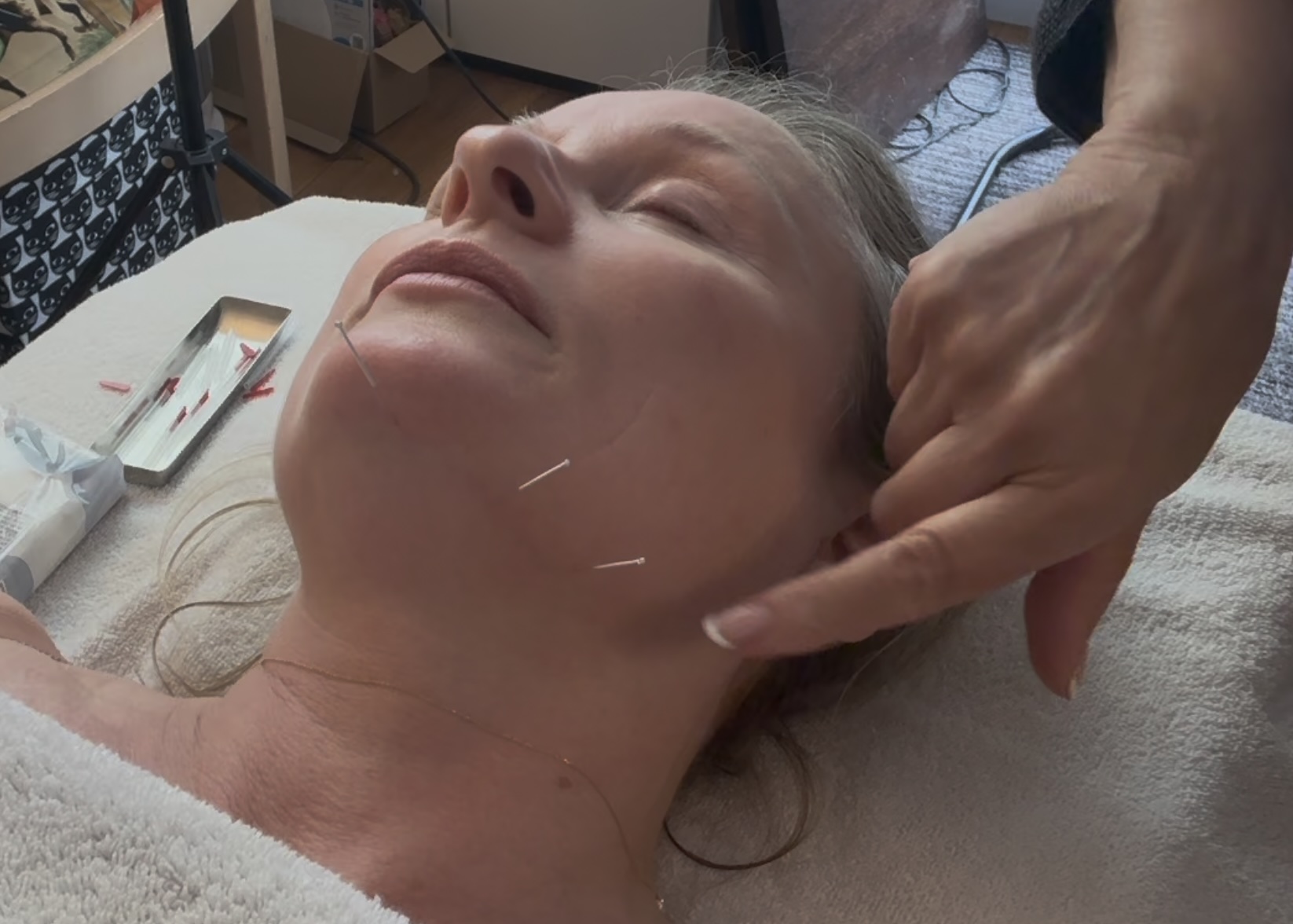 Product image for Improving the Jawline, Neck & Décolleté: A Fascia-Focused Acupuncture Approach - Founding Release