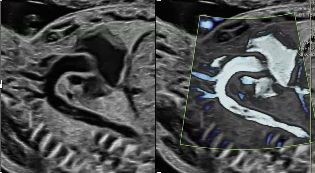 Product image for Introduction to the Fetal Heart: A Sonographer's Perspective