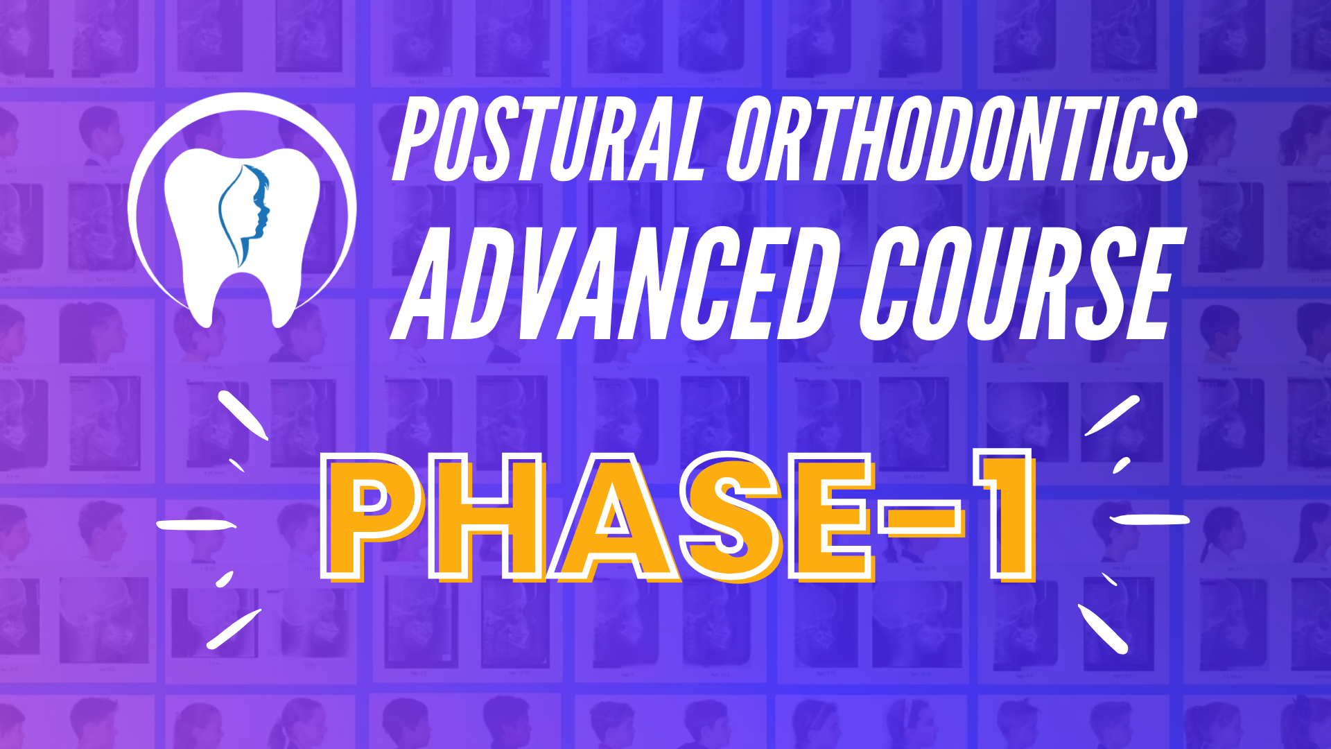 Product image for Postural Orthodontics Advanced Course Phase-1 (Latest))