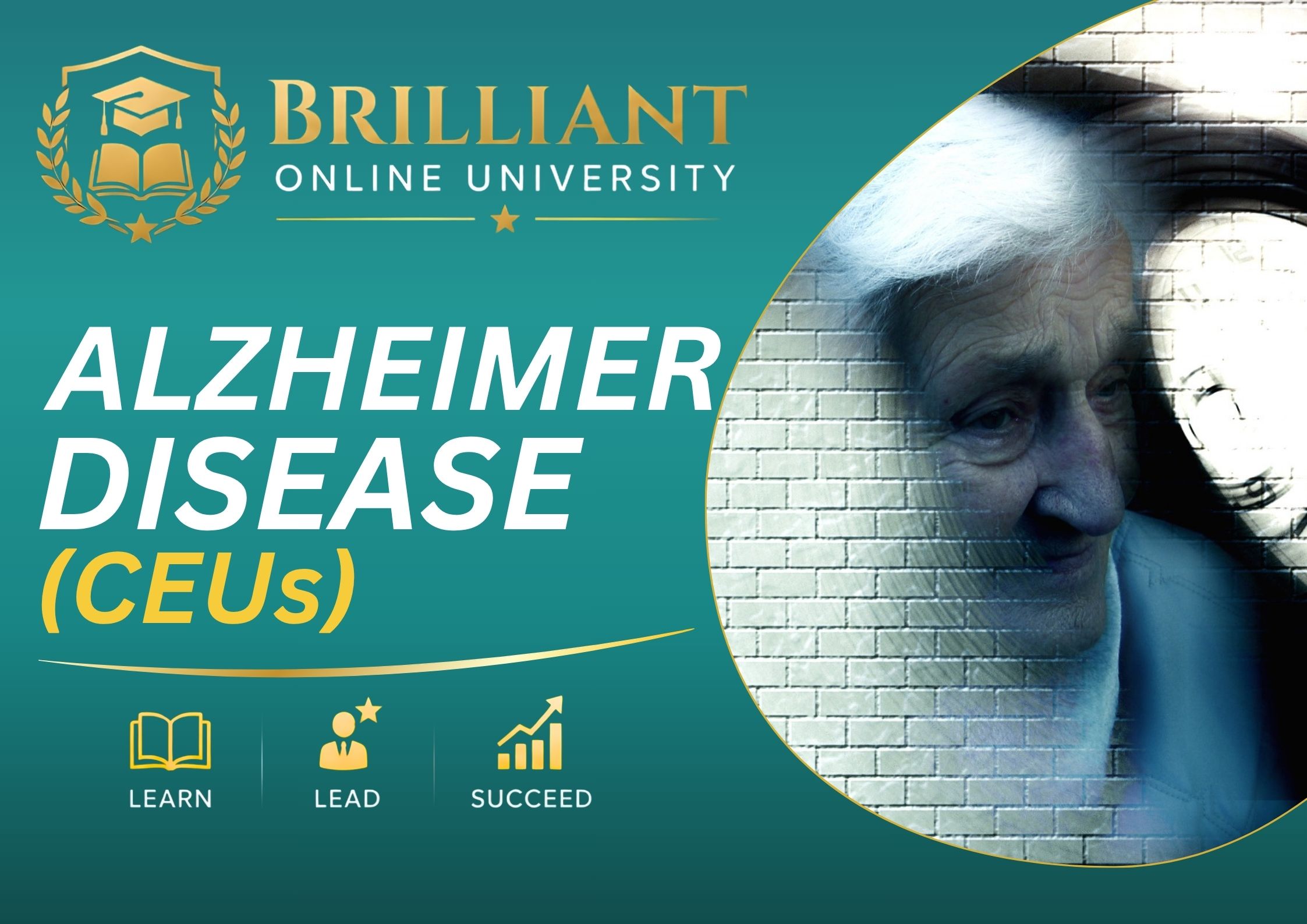 Product image for Alzheimer Disease (CEUs)