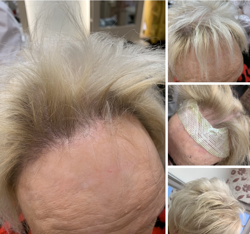Product image for Step Two : Excessive Hair Loss